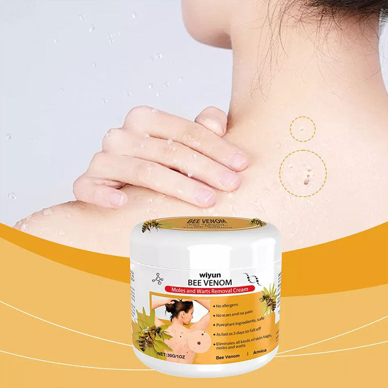Warts Removal Cream