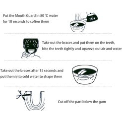 Mouth Guard