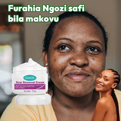 Scar Removal Cream 100% Natural guarantee