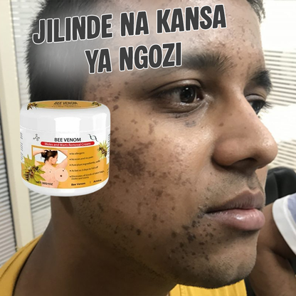 Warts Removal Cream pure natural