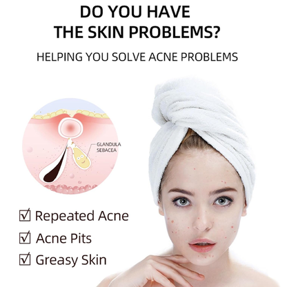Acne Gel