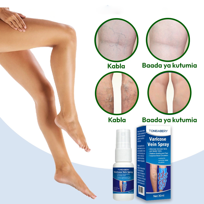 Vein Spray 100% Natural