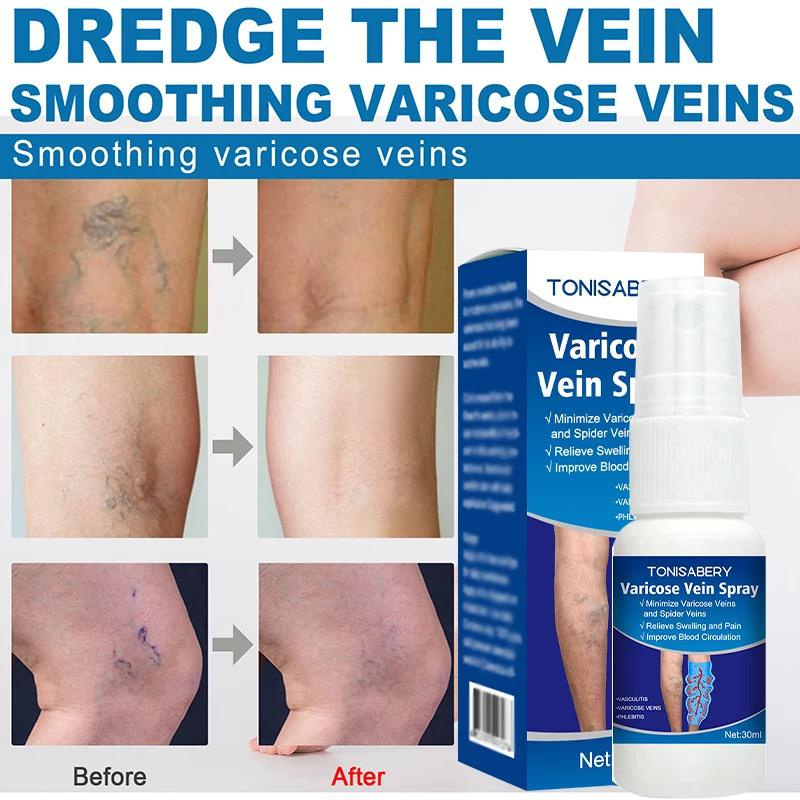 Vein Spray