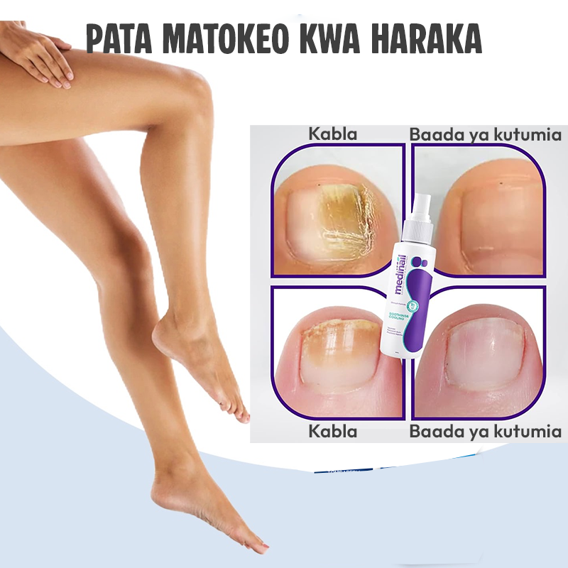 Nail Fungus Spray pure natural