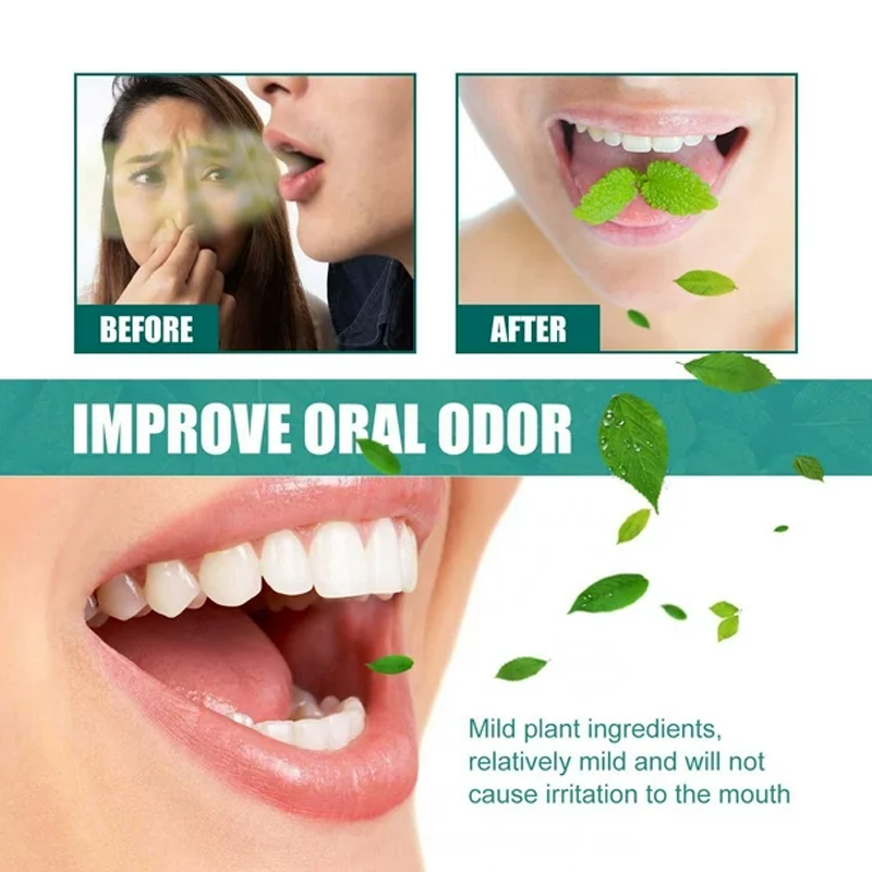 Bad Breath Spray (FM)