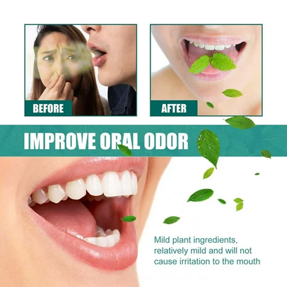 Bad Breath Spray (FM)