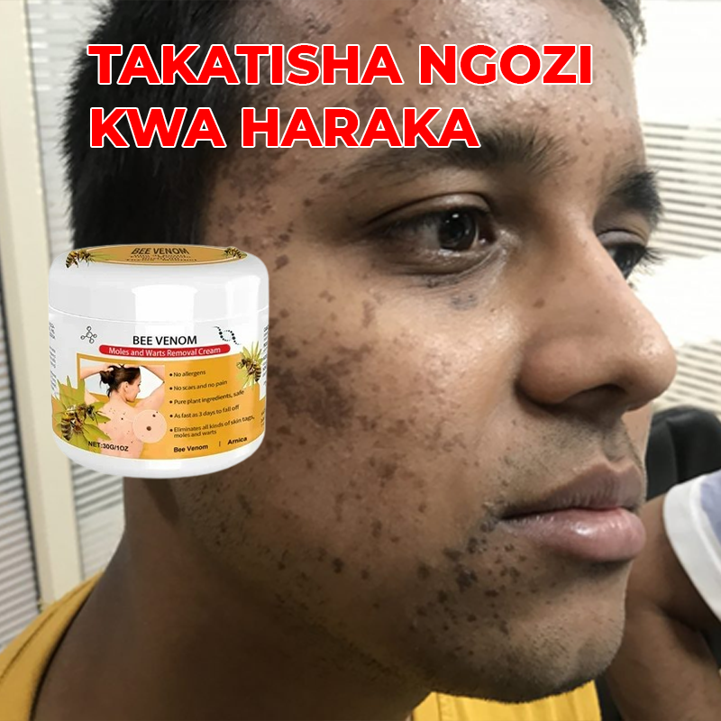 Warts Removal Cream care 100%