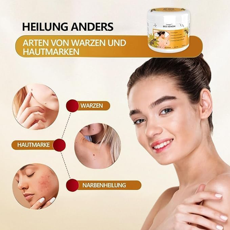 Warts Removal Cream fast results