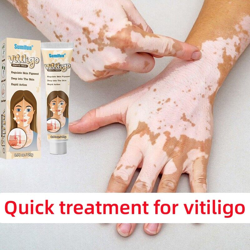 White Spot Cream