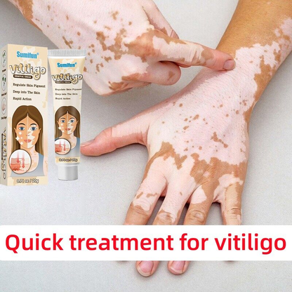 White Spot Cream