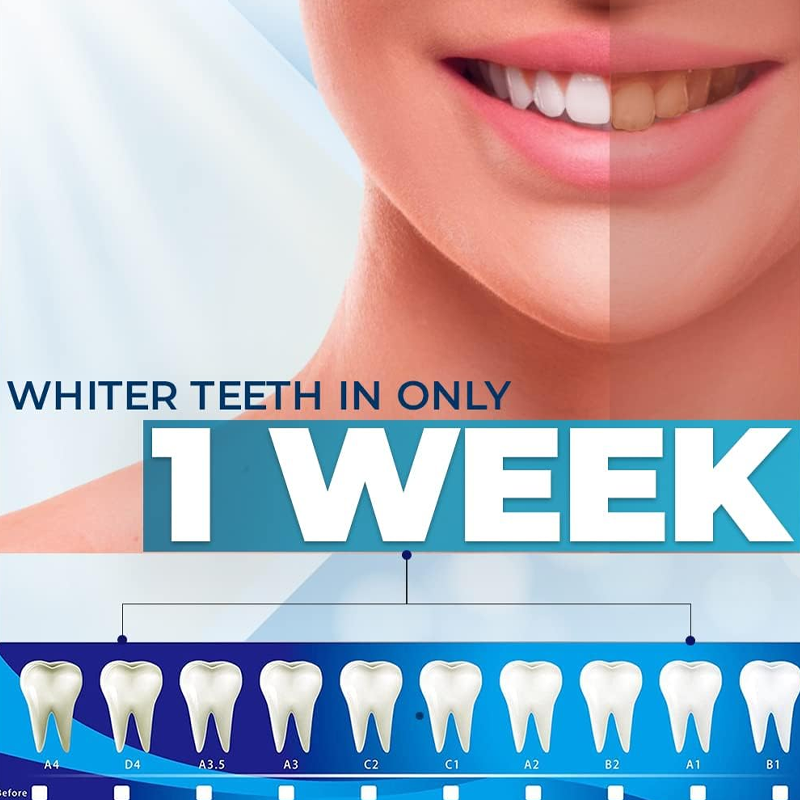 Teeth Whitening Strips