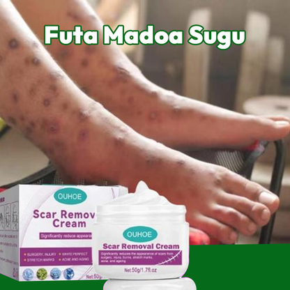 Scar Removal Cream 100% Natural
