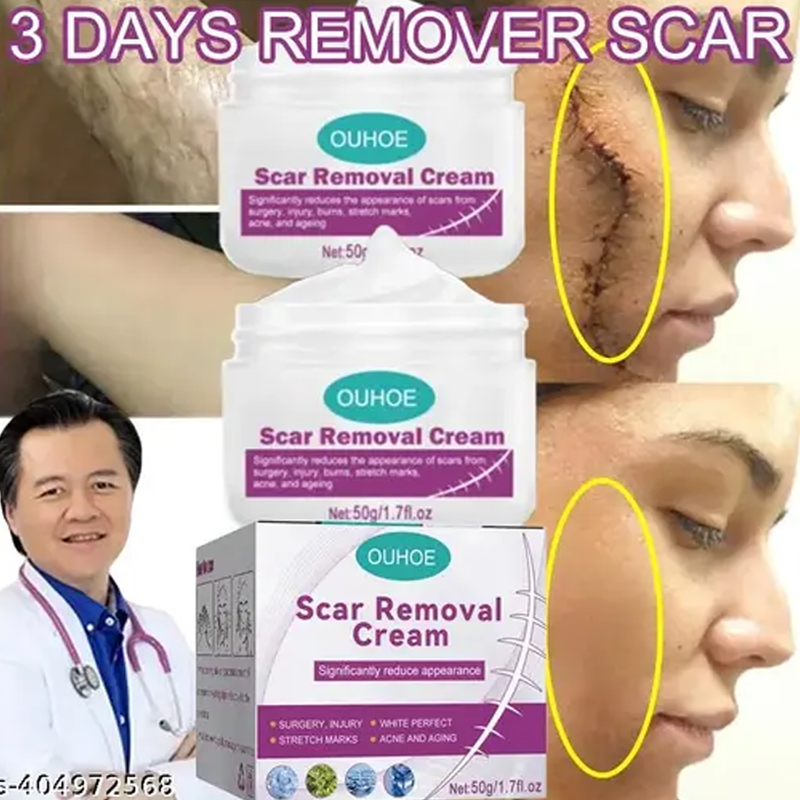 Scar Removal Cream