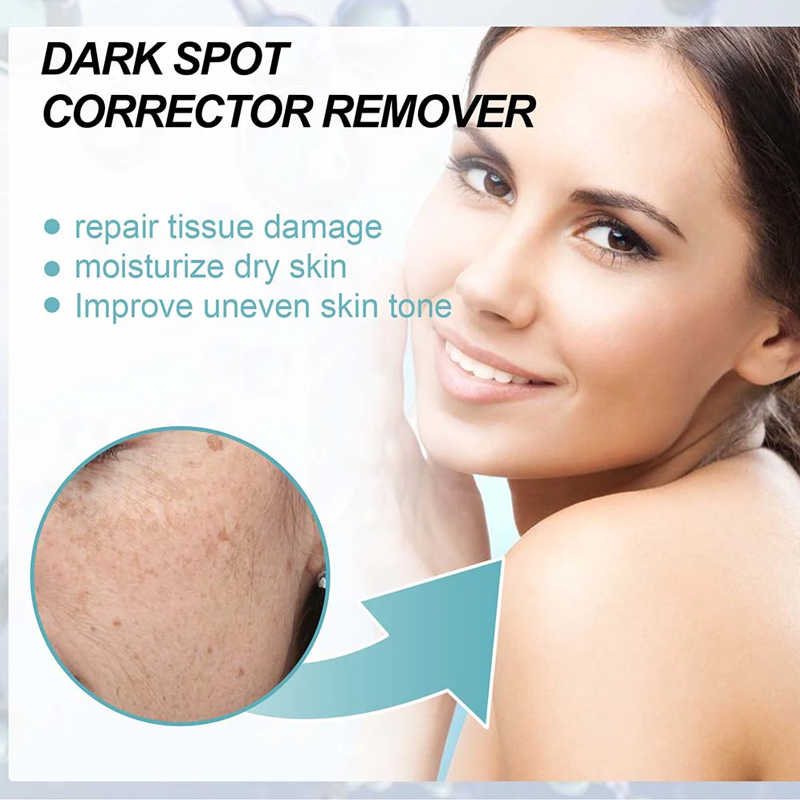 Whitening Facial Cream