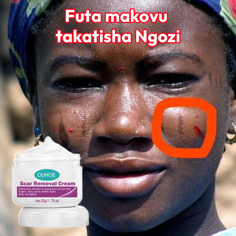 Scar Removal Cream 100% Natural L-650