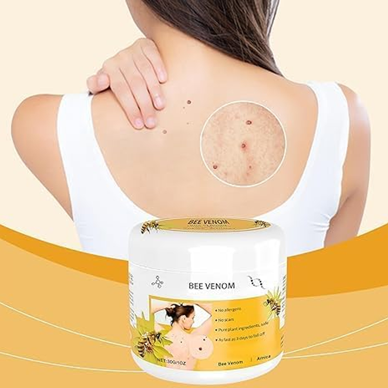 Warts Removal Cream fast results
