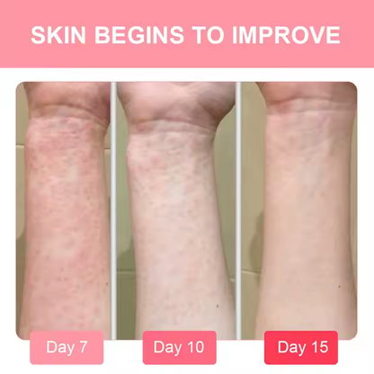 Herbal Skin Spray