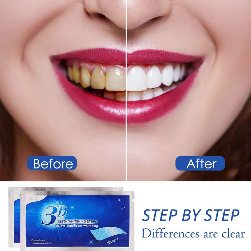 Teeth Whitening Strips