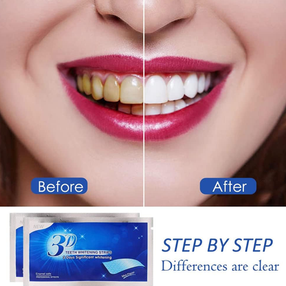 Teeth Whitening Strips