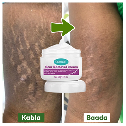 Scar Removal Cream 100% Original