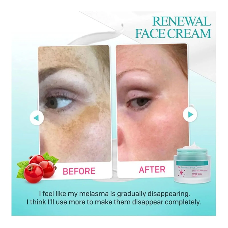 Renewal Face Cream