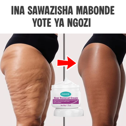 Scar Removal Cream Original