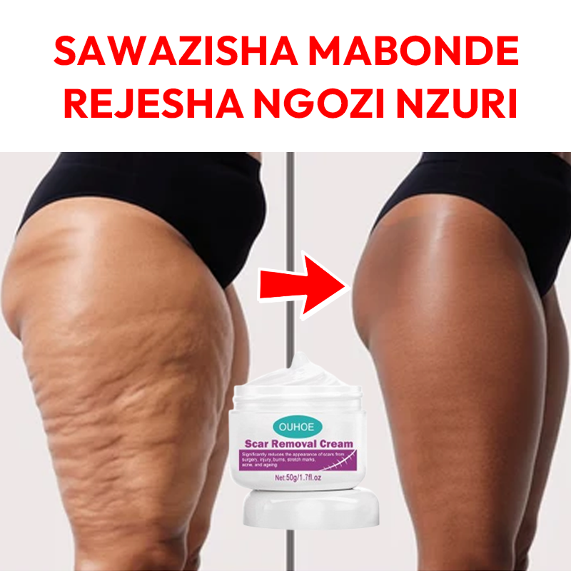 Scar Removal Cream 100% Natural pure