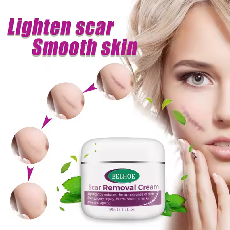 Scar Removal Cream
