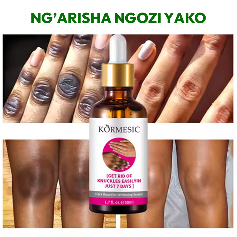 Knuckle Whitening Serum