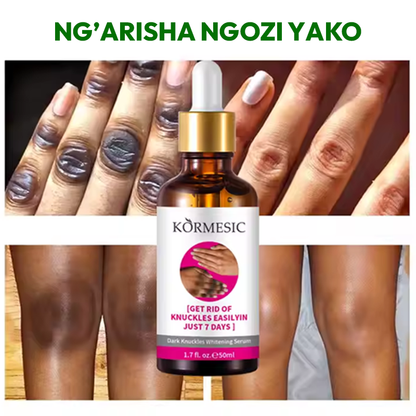 Knuckle Whitening Serum