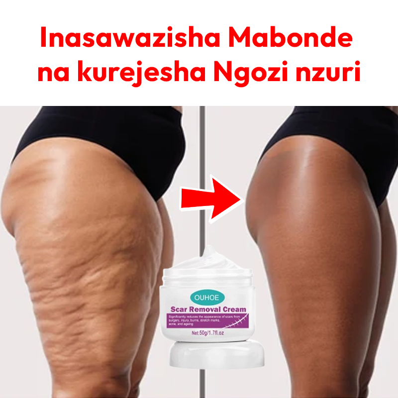 Scar Removal Cream 100% soft skin
