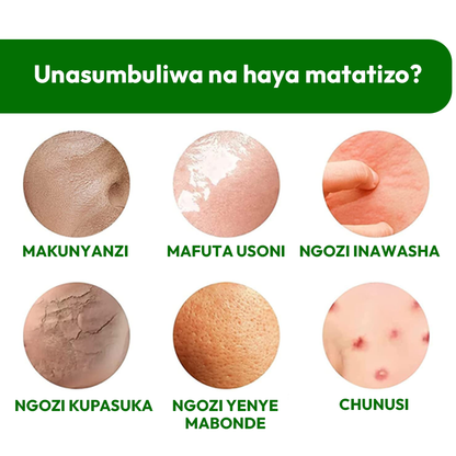 Body Whitening Soap Original 100%