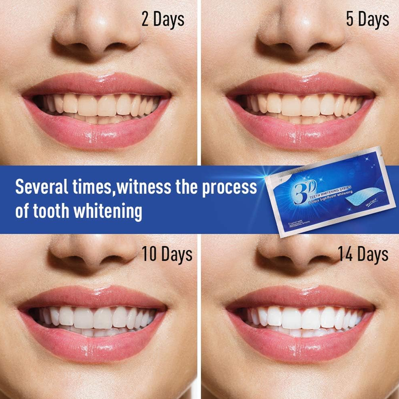 Teeth Whitening Strips