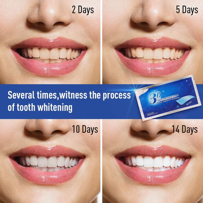 Teeth Whitening Strips