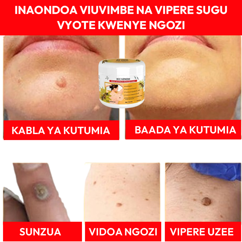 Warts Removal Cream 100% Natural.
