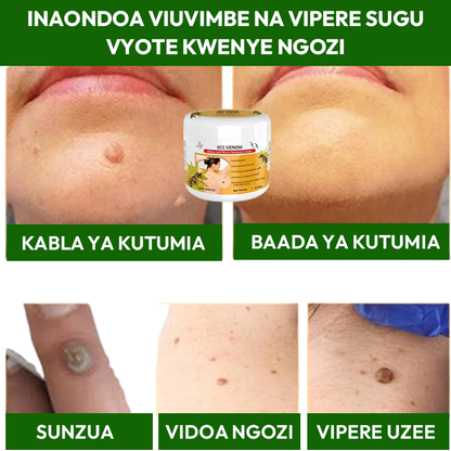 Warts Removal Cream 100% Natural