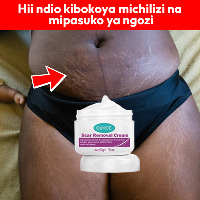 Scar removal cream 100% Guarantee