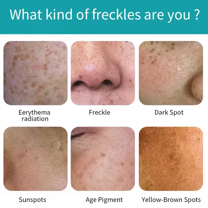Whitening Facial Cream