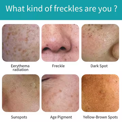 Whitening Facial Cream