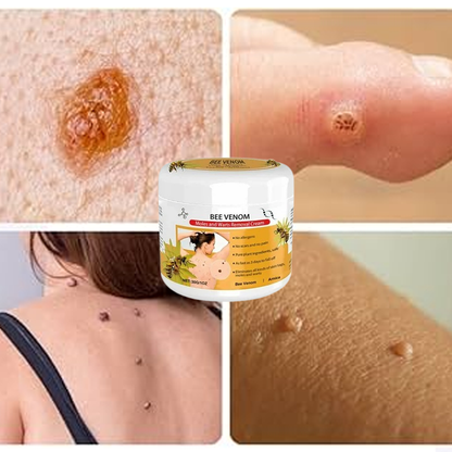 Warts Removal Cream guarantee