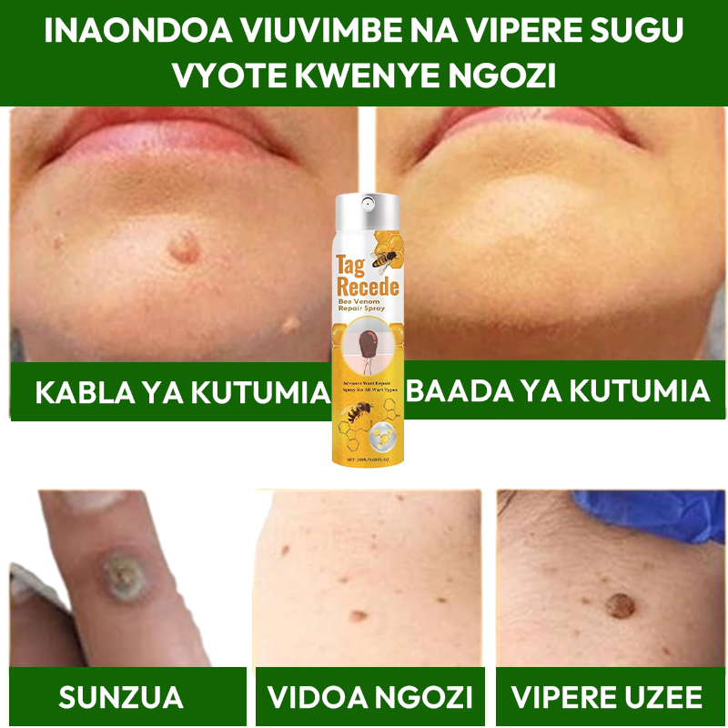 Warts Removal Spray 100% Natural*