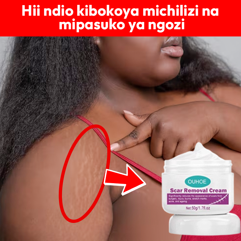 Scar Removal Cream 100% soft skin