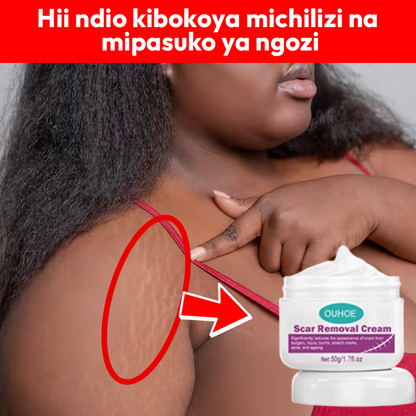 Scar Removal Cream 100% soft skin