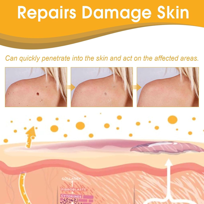 Warts Removal Cream fast results