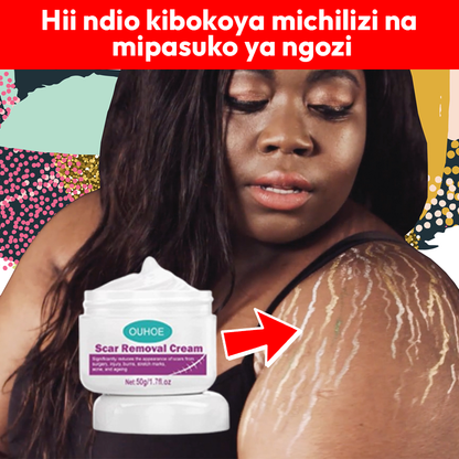 Scar Removal Cream 100% Natural L-650