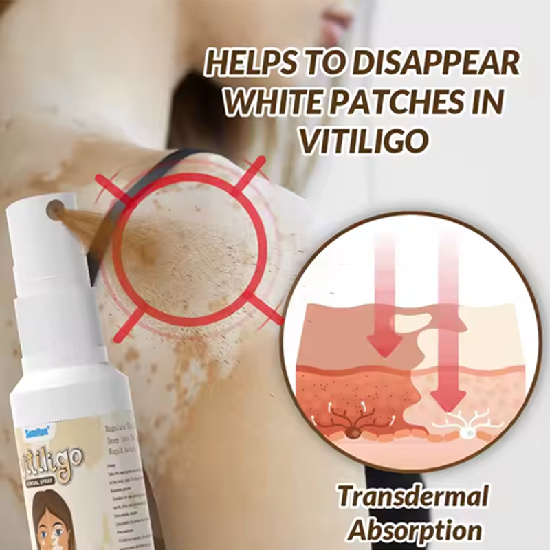 White Spot Cream