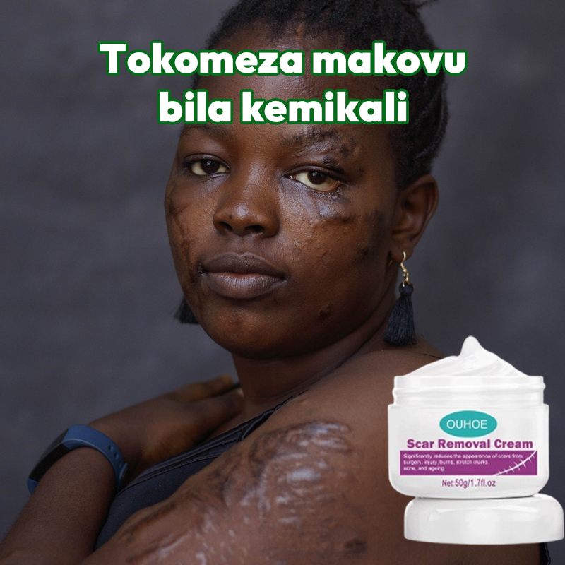 Scar removal cream Natural 100%