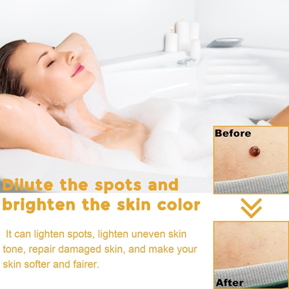 Warts Removal Cream fast results