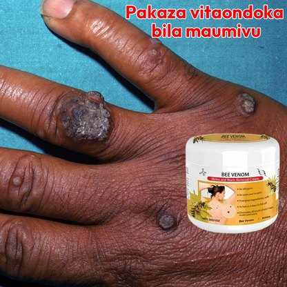 Warts Removal Cream 100% Natural L-84