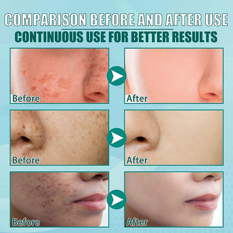 Renewal Face Cream
